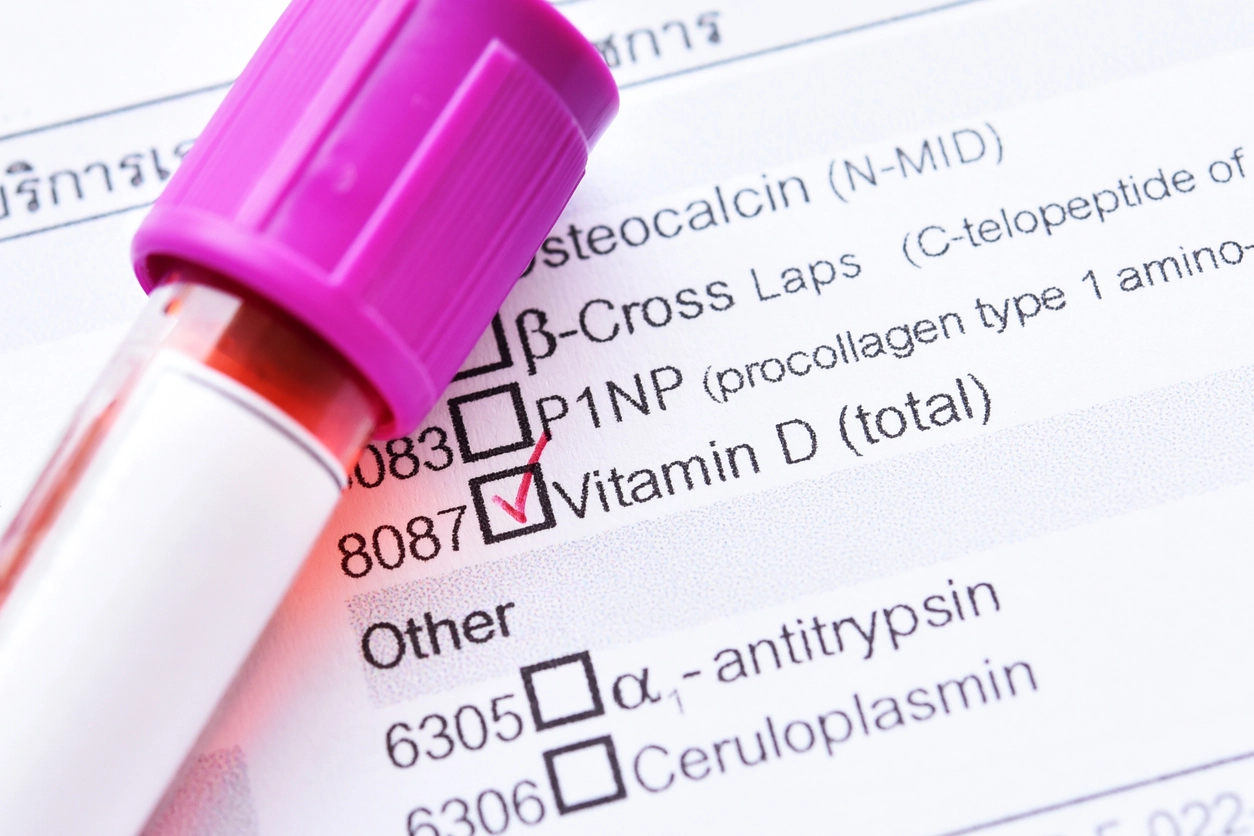 Imagem da notícia Exame de vitamina D: quando fazer, jejum e valores de referência 