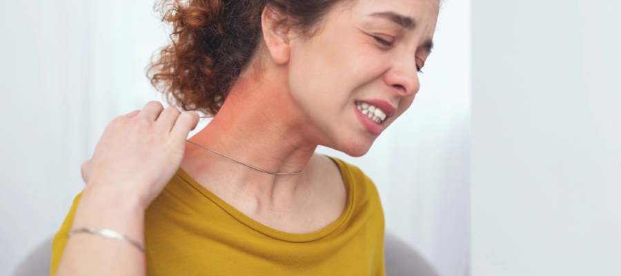 Imagem da notícia Entenda a dermatite de contato: causas, sintomas e tratamento