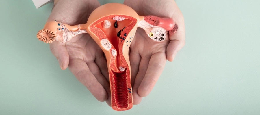 Imagem da notícia Como fica o útero na menstruação? Qual a relação com a cólica?