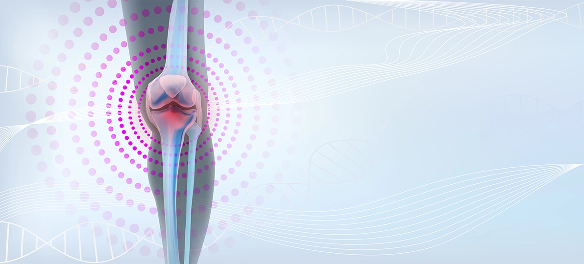 Imagem da notícia Viscossuplementação E Administração Oral Do Ácido Hialurônico No Tratamento Da Osteoartrite